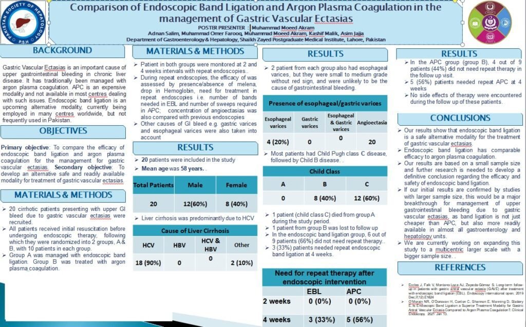 Comparison of Endoscopic Band Ligation and Argon Plasma Coagulation in the management of Gastric Vascular Ectasias